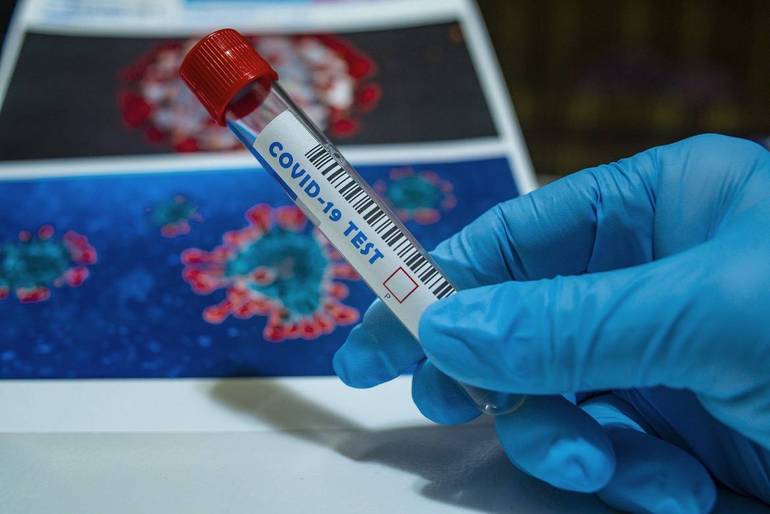 Coronavirus, l'aggiornamento: in Emilia-Romagna su oltre 17.600 tamponi effettuati 2.143 nuovi positivi